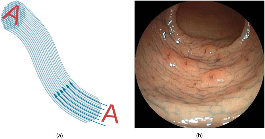 A Figura (a) mostra como uma imagem A é transmitida por meio de um feixe de fibras paralelas. A Figura (b) mostra uma imagem do endoscópio.