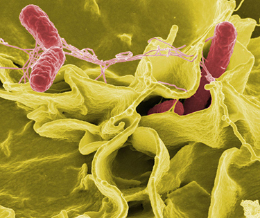 Uma imagem ampliada da bactéria Salmonella atacando uma célula humana. A bactéria tem forma de bastonete e tem cerca de zero ponto sete a um ponto, cinco micrômetros de diâmetro e dois a cinco micrômetros de comprimento.