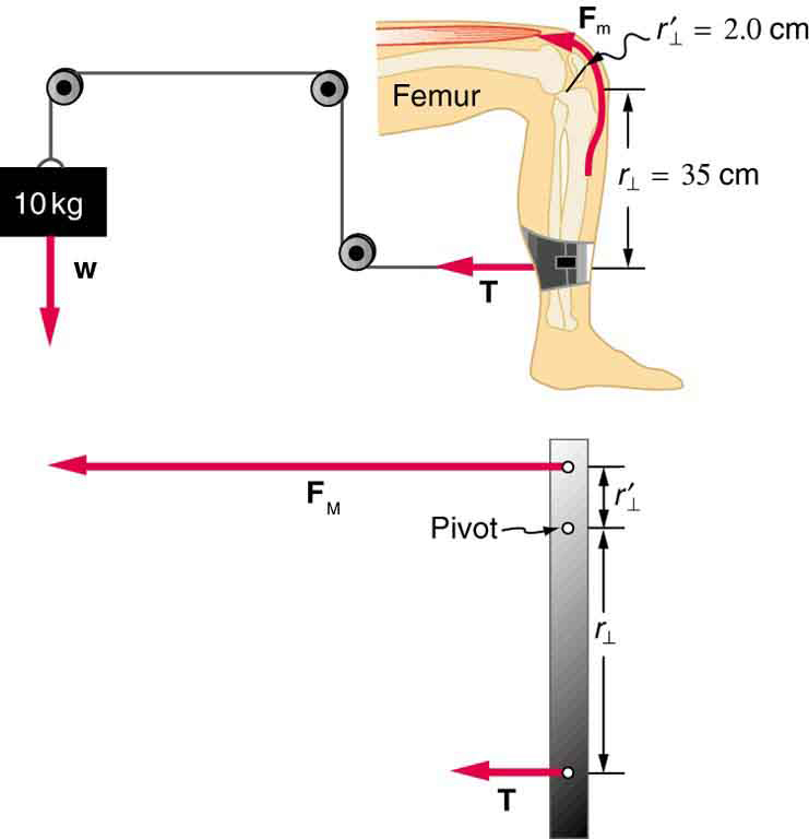 Uma máquina para exercícios de pernas é mostrada. Um fio é amarrado a um manguito ao redor da parte inferior de uma perna. Esse fio passa por três polias e é conectado a um peso de dez kg. A tensão no fio é mostrada perto da perna na direção do fio. Na perna, um ponto no joelho é mostrado como o pivô. A distância entre o pivô e o ponto em que o fio está amarrado à perna é de trinta e cinco centímetros. Um diagrama de corpo livre da perna, representado como um poste, é mostrado.