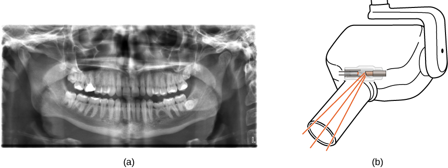 يوضح الشكل (أ) صورة الأشعة السينية للمنظر الأمامي للفك، وخاصة الأسنان. يوضح الشكل (ب) رسمًا لجهاز الأشعة السينية للأسنان.