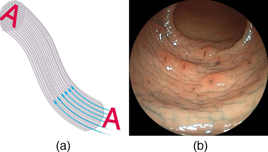 A figura (a) mostra como uma imagem A é transmitida através de um feixe de fibras paralelas. A figura (b) mostra uma imagem de endoscópio.