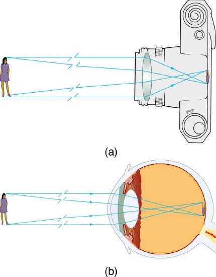 Figure (a) shows incident rays coming from an object (a girl) and falling on a convex lens in a camera. The rays after refraction produce an inverted, real, and diminished image on the film of the camera. Figure (b) shows the same object in front of a human eye. The rays from the object fall on the convex lens and on refraction produce a real, inverted, and diminished image on the retina of the eyeball.