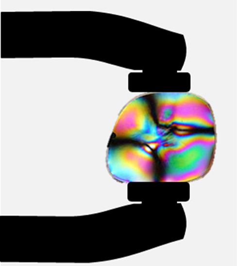 A figura mostra uma fotografia de uma lente de plástico que está sendo comprimida por uma pinça. Aparecem padrões de arco-íris, mostrando a deformação da lente. As regiões coloridas são delineadas por curvas escuras conectando os centros das bordas da lente.