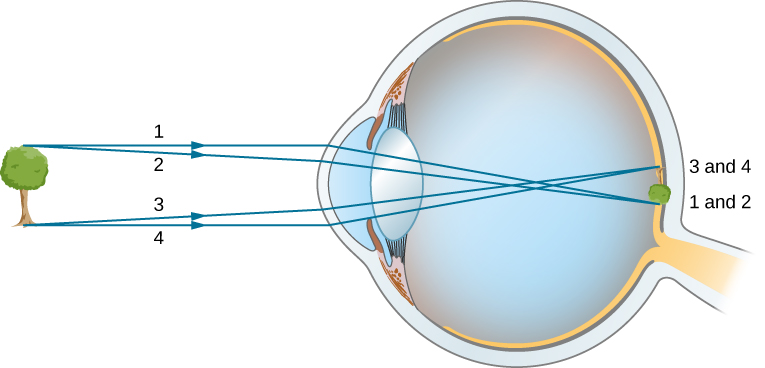 A figura mostra uma árvore na frente de um olho. Os raios da parte superior e inferior da árvore atingem a córnea do olho. Eles são refratados, se cruzam no meio do humor vítreo e alcançam a retina. A imagem formada na retina é pequena e invertida.
