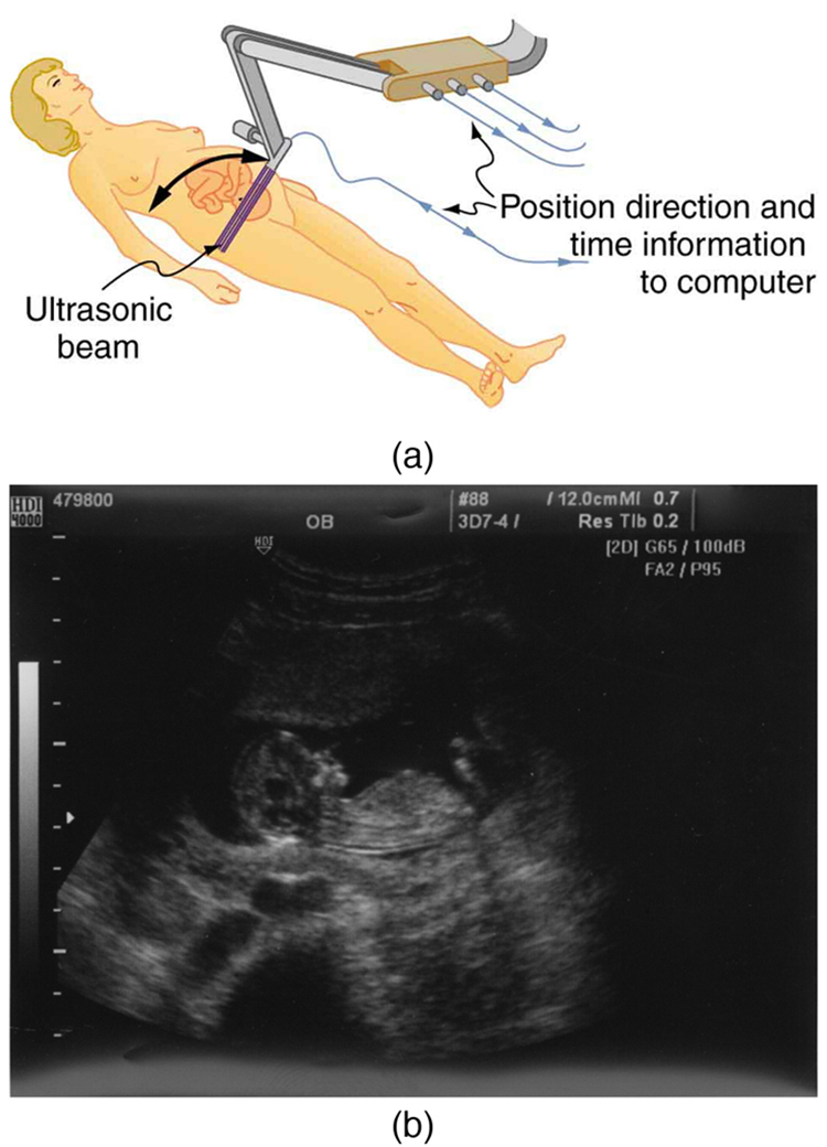 A primeira parte do diagrama mostra um aparelho de ultrassom escaneando o abdômen de uma mulher. A segunda parte do diagrama é um relatório de ultrassonografia do abdome.