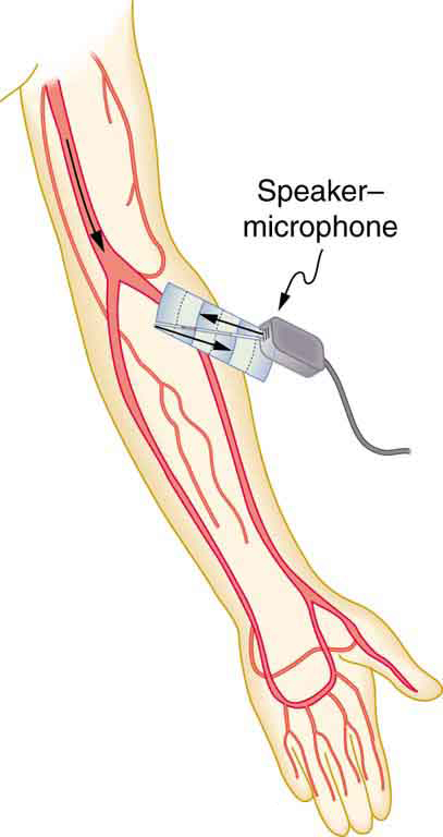 A imagem representa um aparelho de ultrassom que escaneia as artérias e veias de uma mão humana.