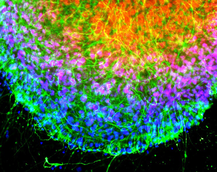 Uma imagem colorida de células de galinha ao microscópio é mostrada. Os núcleos das células brilham em azul, enquanto os neurofilamentos que conectam essas células brilham em verde sob luz ultravioleta.