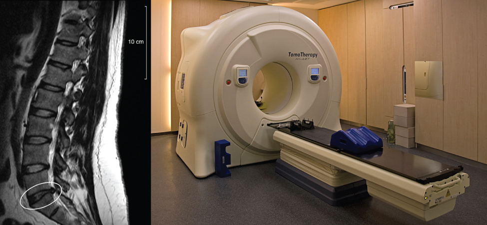 A imagem à esquerda mostra uma imagem da coluna vertebral humana tirada por ressonância magnética. A imagem à esquerda é uma fotografia do instrumento de ressonância magnética.