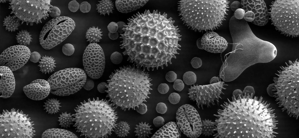 La photo montre un groupe de molécules de pollen. Toutes les molécules ont une forme circulaire ou ovale. Certaines molécules ont une morphologie granulaire, d'autres ont de nombreux picots qui sortent de leur surface.